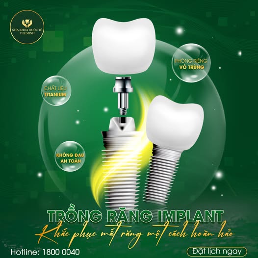 LỢI ÍCH CỦA CẤY GHÉP IMPLANT TẠI NHA KHOA QUỐC TẾ TUỆ MINH