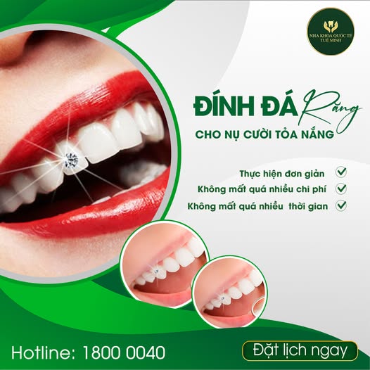 ĐÍNH ĐÁ RĂNG NỤ CƯỜI TỎA NẮNG