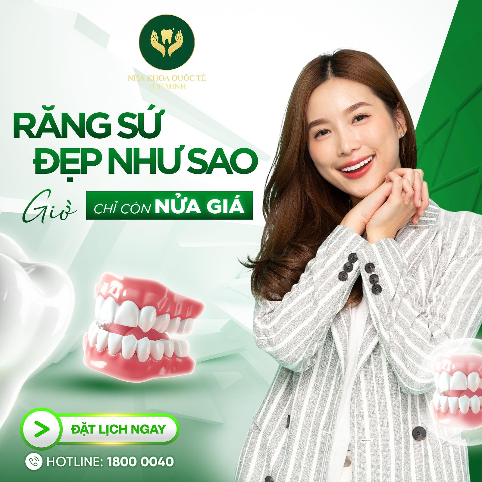 RĂNG SỨ ĐẸP NHƯ SAO – ƯU ĐÃI NGẬP TRÀN TẠI NHA KHOA QUỐC TẾ TUỆ MINH